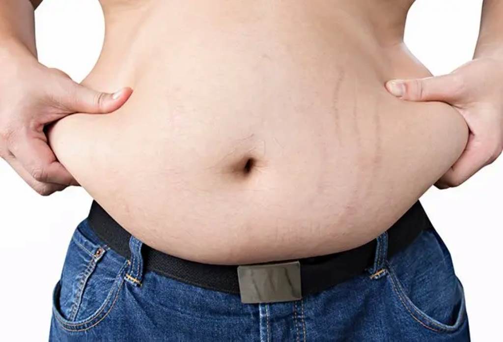 losing belly fat